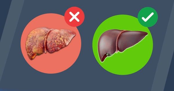 Nettoyage du foie pour se debarrasser de la graisse du ventre